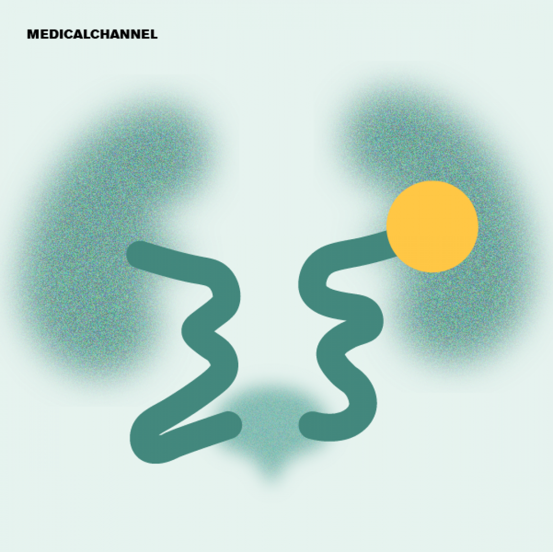 Advances in Nephrology: From Transplant Rejection to Preeclampsia Genetics