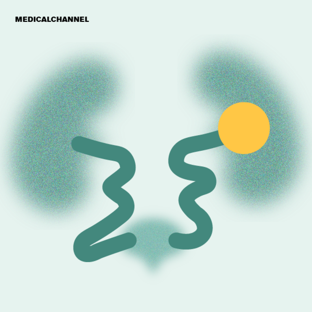 Cardiorenal Connections: From Pregnancy Risks to Genetic Challenges