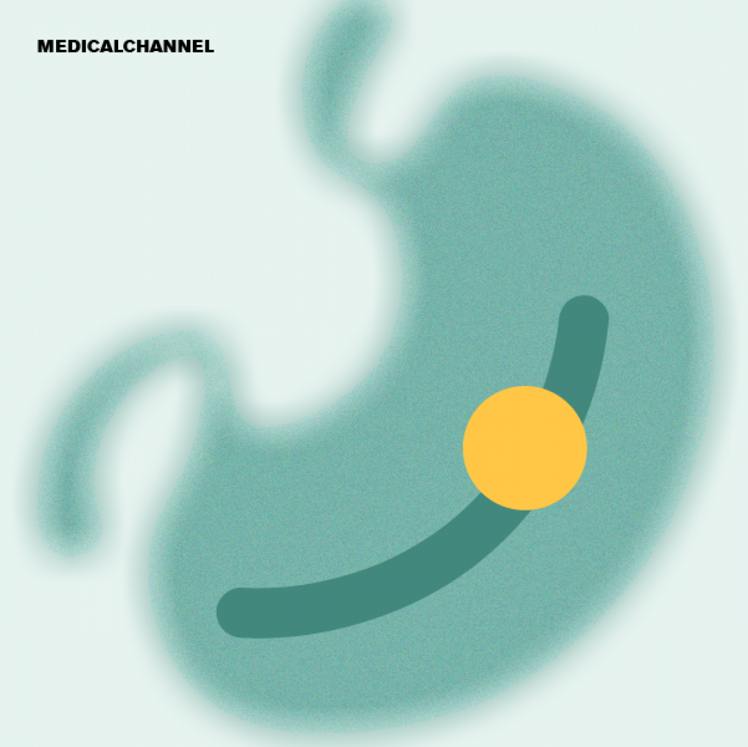 Cirrhosis Reimagined: From Clotting Myths to Digital Health Breakthroughs